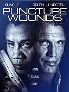 Click image for larger version

Name:	puncture-wounds.jpg
Views:	1
Size:	19.1 KB
ID:	44004